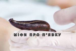 Міфи про п'явку